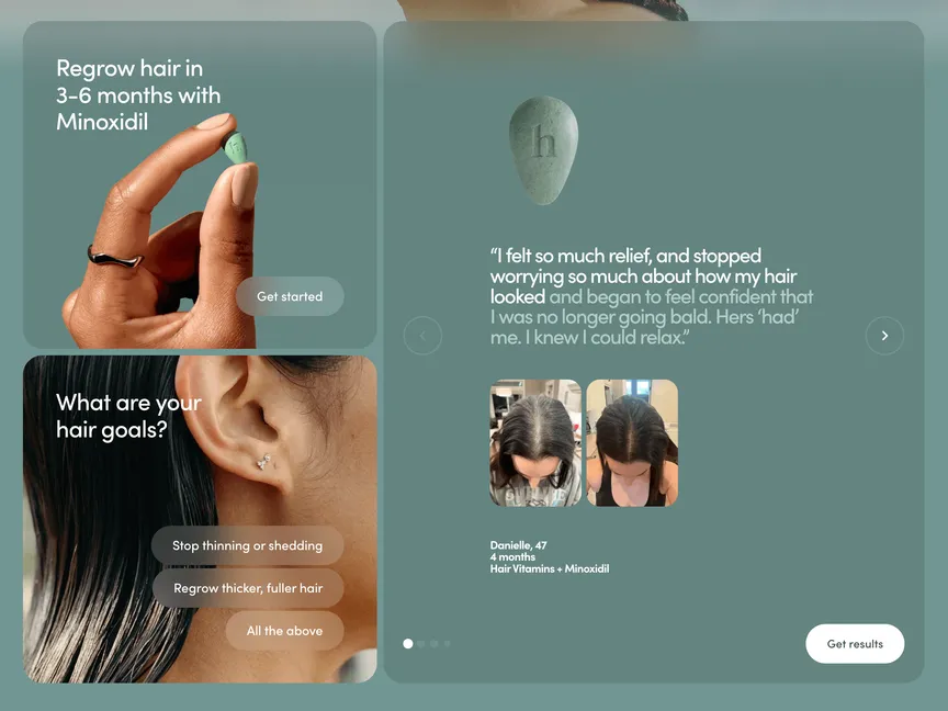 Category preview for Before-and-after